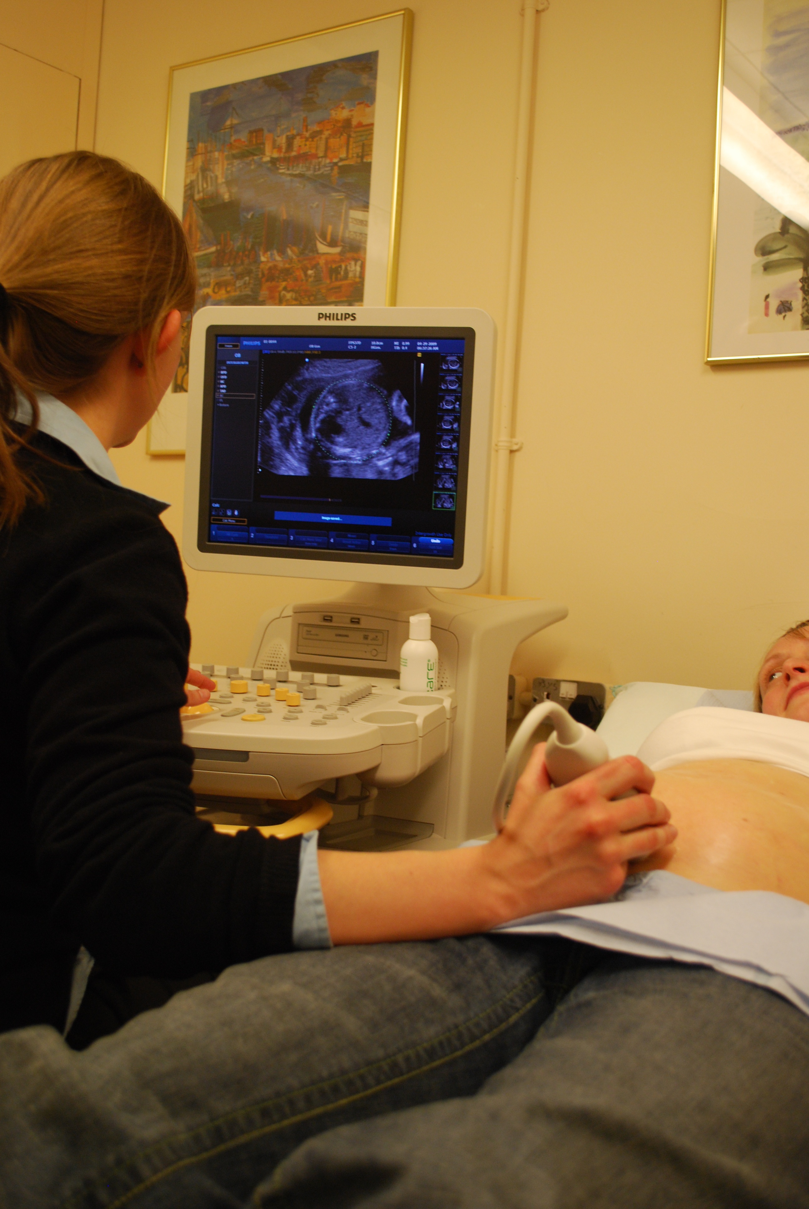 A foetal ultrasound scan as part of the study