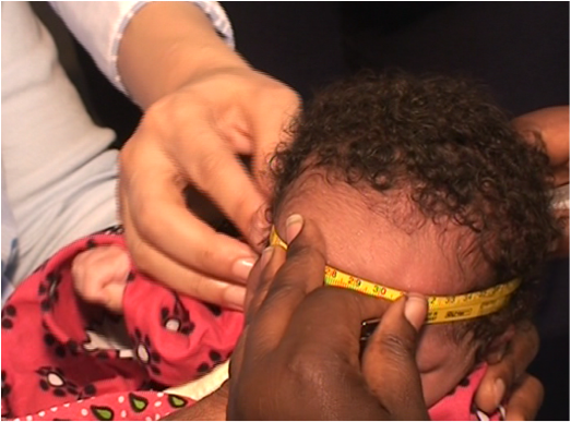 Head circumference measurement in Kenya during the study