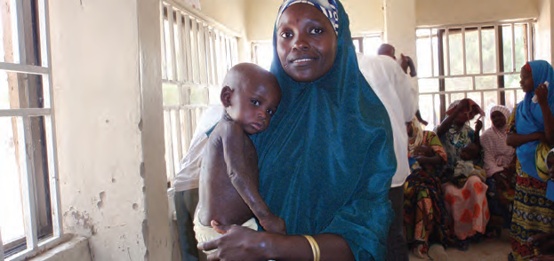A mother attends with her enrolled infant in a CMAM programme