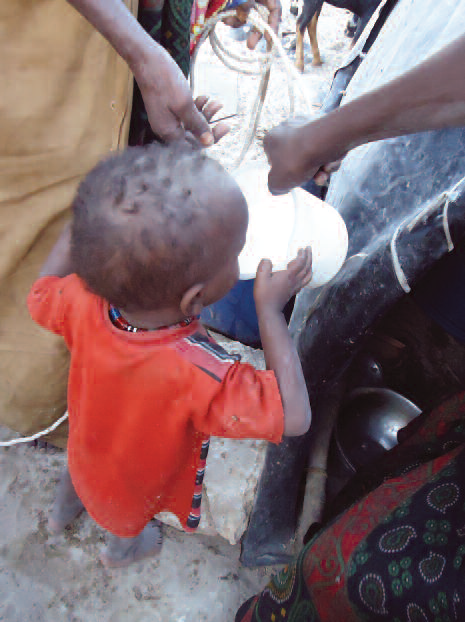 Milk consumption by malnorished Children
