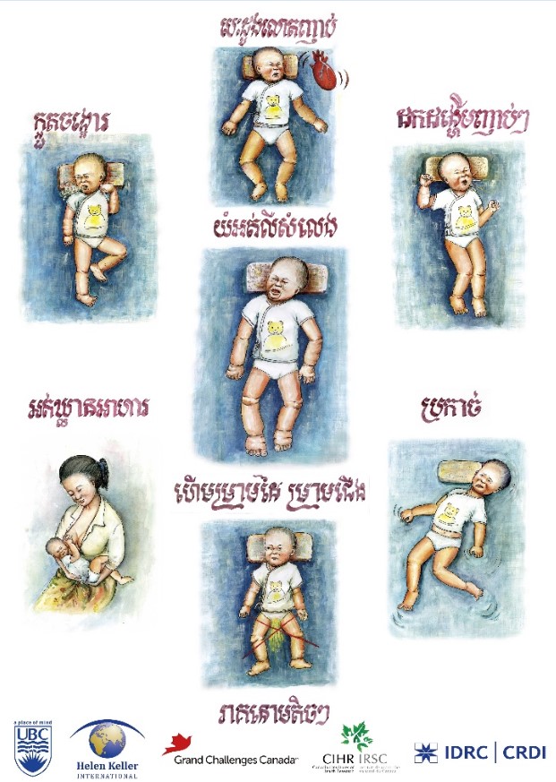 Educational poster describing the common signs of infantile beriberi (in Khmer)