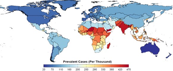 Map of the world showing the excess underweight prevalence, in children with clefts aged less than 5 years in both sexes. There is a colour gradient from blue to red to distinguish between the countries with a lower number of prevalent cases per thousand from those with a higher prevalence. 