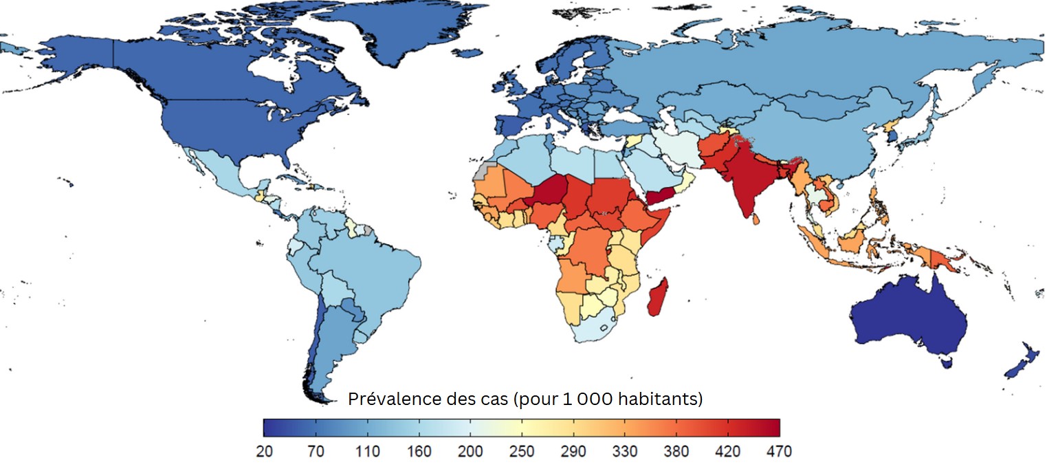 Carte du monde montrant une prévalence élevée de l’insuffisance pondérale chez les enfants, garçons et filles, de moins de 5 ans présentant une fente labio-palatine . Le dégradé de couleurs du bleu au rouge permet de distinguer les pays en fonction du nombre de cas prévalents pour mille, du plus faible (bleu) au plus élevé (rouge). 