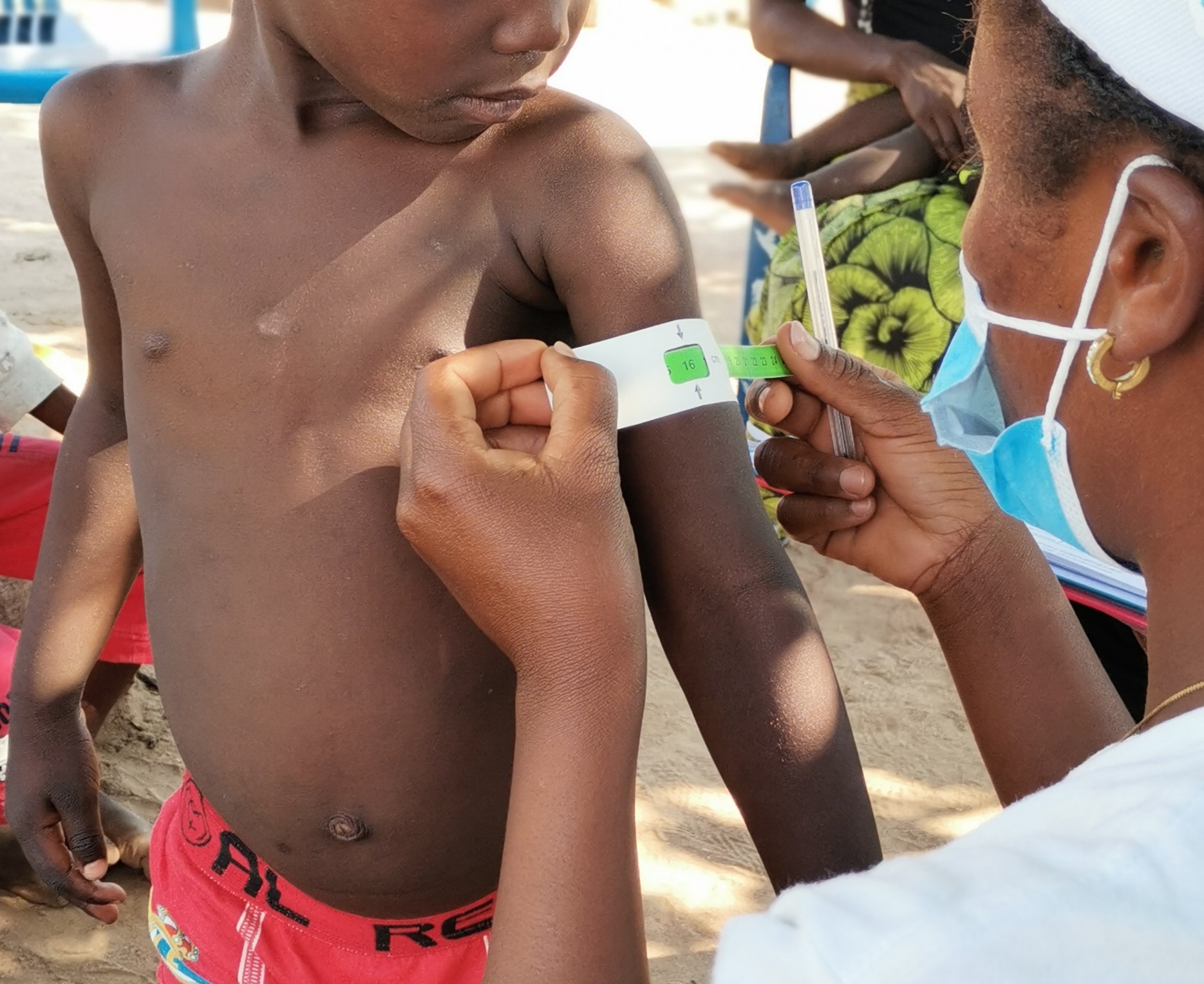 Mid-upper arm circumference measurement from a nutrition survey in Angola, 2021